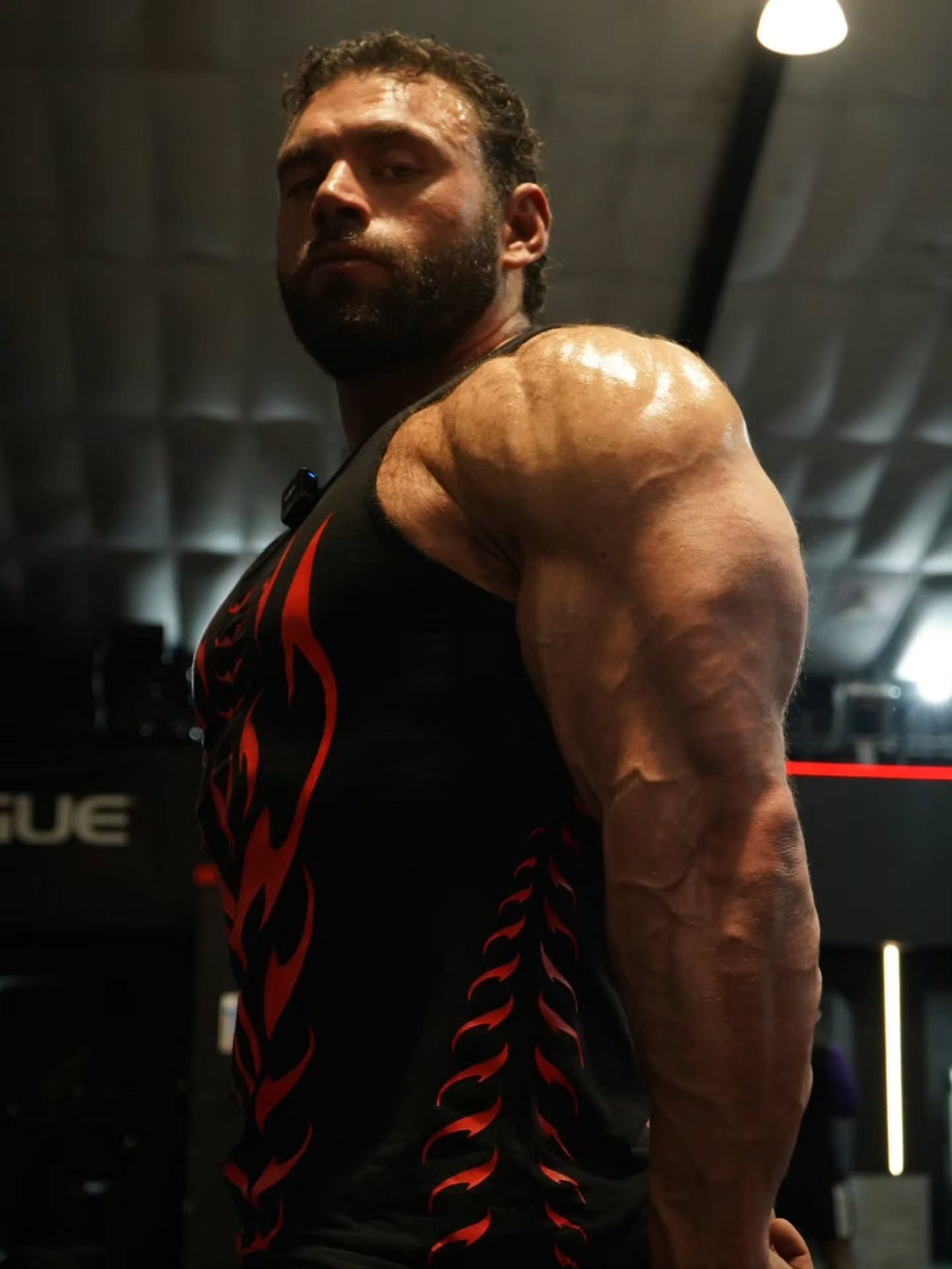 Arm Vascularity